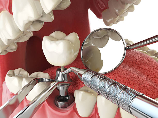 Best Emergency Cosmetic Dentistry (e.g., broken veneers) in New Glarus, WI